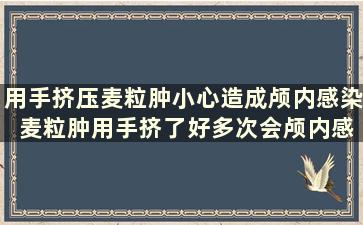 用手挤压麦粒肿小心造成颅内感染 麦粒肿用手挤了好多次会颅内感染吗